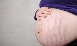 Những bệnh ở da khi mang thai c&#243; ảnh hưởng đến thai nhi?