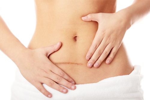 5 sự thật về 'dao kéo' ít người quan tâm - 4