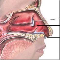 
	Cần tìm dị nguyên gây bệnh viêm mũi dị ứng để điều trị tận gốc.