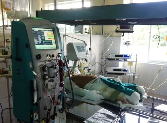 Chiến sĩ bị thương nặng trong vụ máy bay rơi đang được điều trị tích cực tại Viện Bỏng quốc gia. Ảnh do bác sĩ cung cấp
