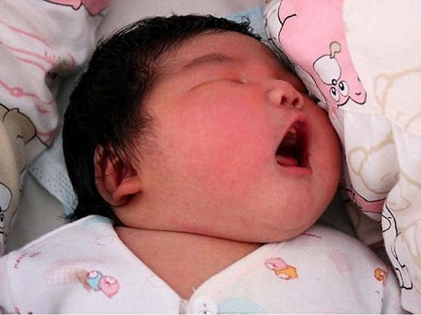 Bé trai mới sinh có cân nặng 6,5kg. (Nguồn: DM)