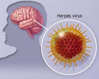 Virút Herpes