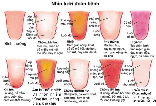 Đoán sức khỏe qua lưỡi của bạn