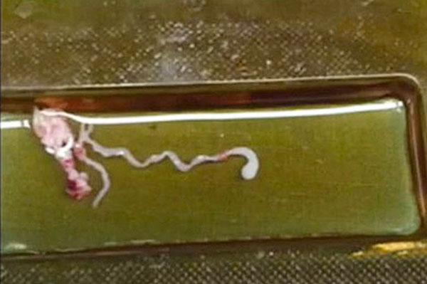 parasite-7608-1417142137.jpg
