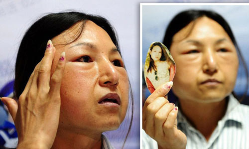 Sốc với 200.000 khuôn mặt bị phẫu thuật thẩm mỹ thành... quỷ tại Trung Quốc 1