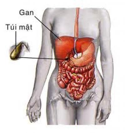 Sỏi túi mật là một trong những nguyên nhân gây&nbsp;đau bụng.