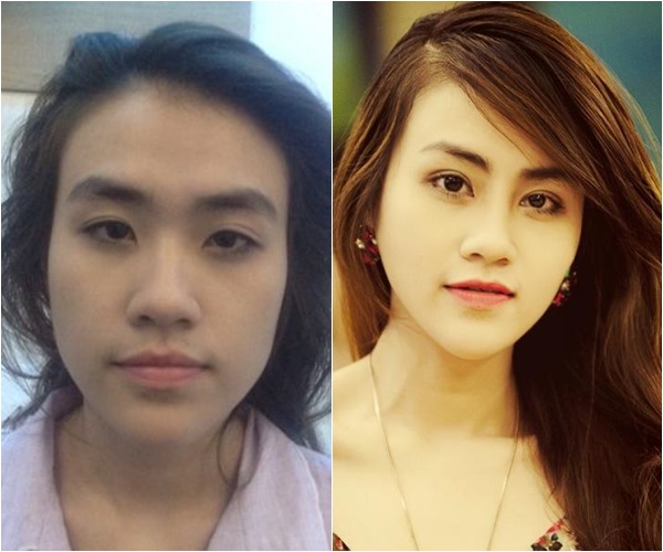 Hình ảnh: Chàng trai được phẫu thuật thành cô gái với 1 tỷ đồng số 14