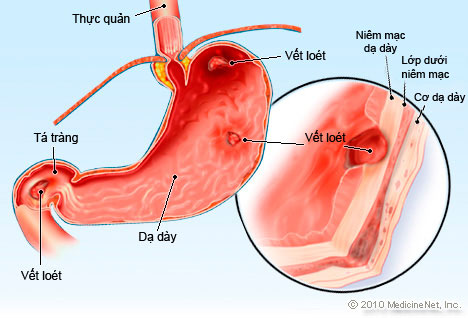 4. Chế Độ Dinh Dưỡng Và Phòng Ngừa