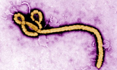 Vi rút Ebola.