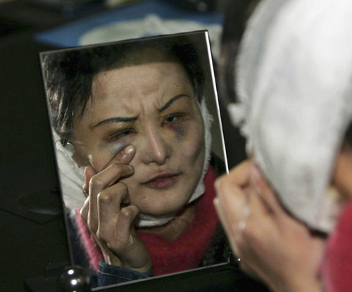 Sốc với 200.000 khuôn mặt bị phẫu thuật thẩm mỹ thành... quỷ tại Trung Quốc 7