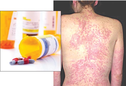 Thuốc có thể gây ra những tác dụng phụ không mong muốn.