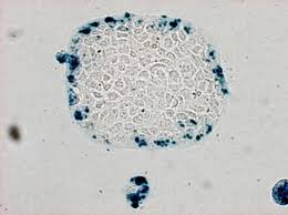 T-antigen, chất ngăn chặn tế bào ung thư da