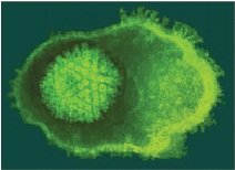 Virus Varicella-Zoster gây bệnh thủy đậu.