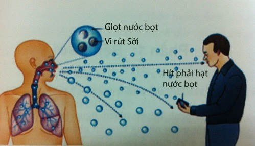 Cơ chế lây truyền của virut sởi.