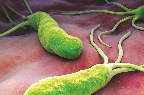 Vi khuẩn Helicobacter pylori là thủ phạm chủ yếu gây viêm loét dạ dày, trong đó có bờ cong nhỏ