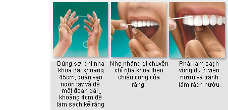 Cách dùng chỉ nha khoa