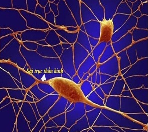 Hình ảnh của tế bào thần kinh.