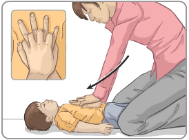 Kĩ thuật ép ngực ở trẻ em trên 1 tuổi