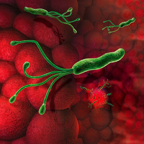 Helicobacter Pylori