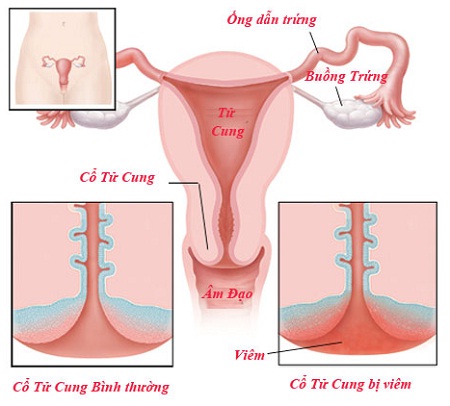 Nguyên Nhân Dẫn Đến Đau Bụng Kinh: Hiểu Rõ Và Khắc Phục Hiệu Quả