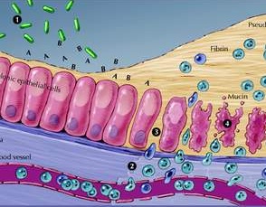 Vi khuẩn C-difficile gây bệnh tiêu chảy.