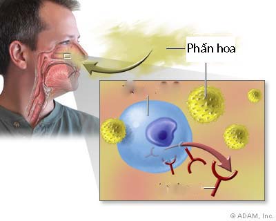 Phấn hoa là một thủ phạm khiến viêm mũi dị ứng gia tăng.