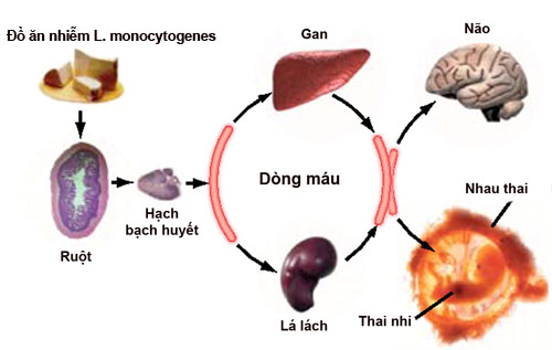 L-monocytogenes-6008-1421833172.jpg