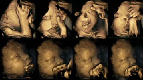 ultrasound-fetuses-react-to-sm-6052-6666