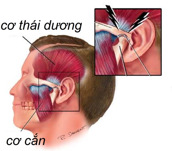 4. Cách chẩn đoán và điều trị viêm cơ hàm