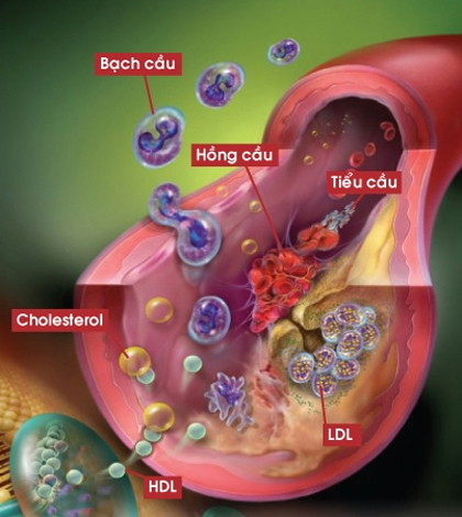 6. Tiên lượng và biến chứng