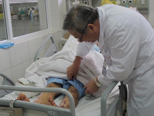 Bênh nhân bị viêm màng não mô cầu đang được điều trị Bênh nhân bị viêm màng não mô cầu đang được điều trị