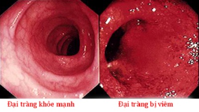 4. Phương Pháp Chẩn Đoán