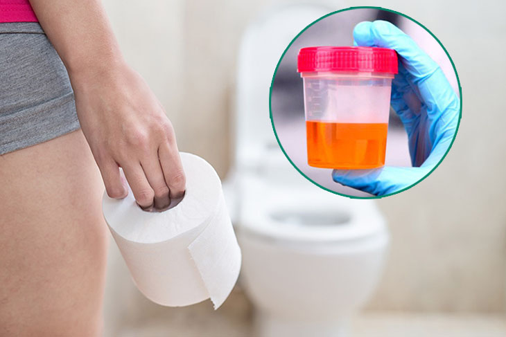 Tiểu ra máu khi nào là cảnh báo bệnh lý nghiêm trọng?- Ảnh 2.