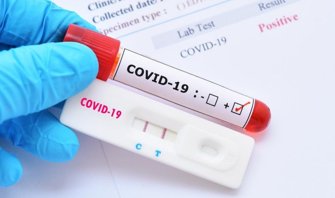 Bộ Y tế: Người chưa tiêm đủ liều vaccine COVID-19 ở vùng dịch về phải cách ly 14 ngày; xét nghiệm 3 lần - Ảnh 1.
