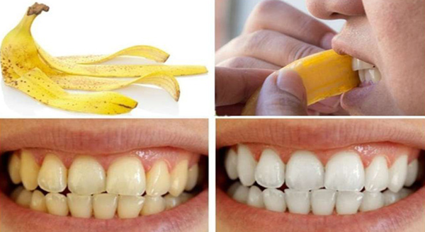 Đừng để răng ố vàng kém xinh, áp dụng những cách sau, hàm răng bạn trắng sáng tự nhiên không lo hóa chất - Ảnh 11.