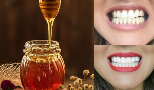 Đừng để răng ố vàng kém xinh, áp dụng những cách sau, hàm răng bạn trắng sáng tự nhiên không lo hóa chất - Ảnh 15.