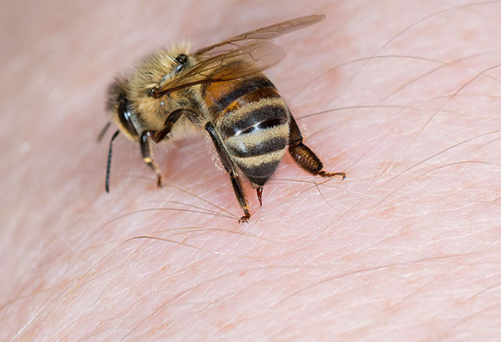 Xử trí đúng cách: Hình ảnh này sẽ chỉ cho bạn cách xử trí đúng cách khi gặp các tình huống với ong. Hãy cẩn thận để tránh tăng thêm hậu quả nặng nề cho bản thân và cả cho các chú ong.