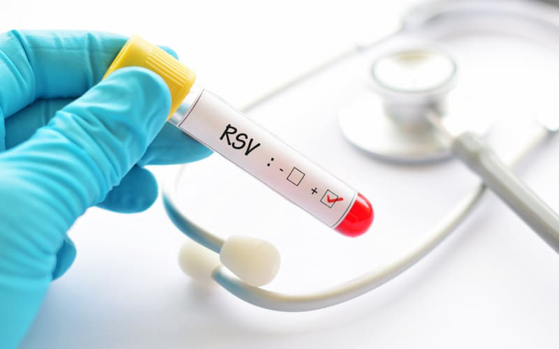 Virus RSV - "Kẻ thù" gây bệnh hô hấp ở trẻ nhỏ