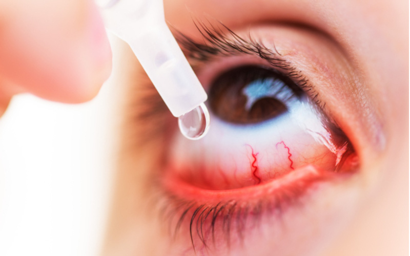 Các thuốc dùng trị đau mắt đỏ