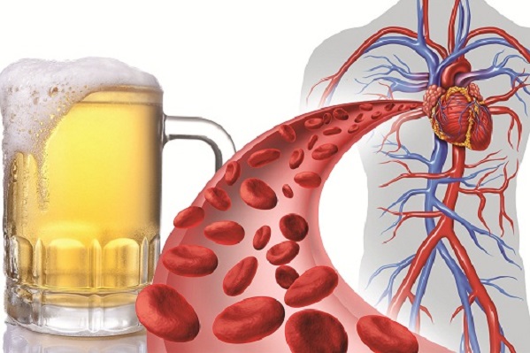 Rượu bia có tác động đến sức khoẻ tim mạch. (Ảnh minh hoạ).