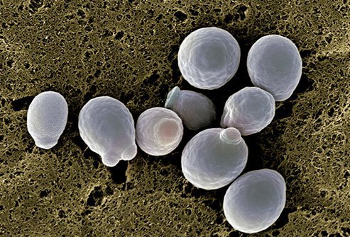 Nhiễm trùng nấm dương vật: Các triệu chứng, nguyên nhân và cách điều trị - Ảnh 2.