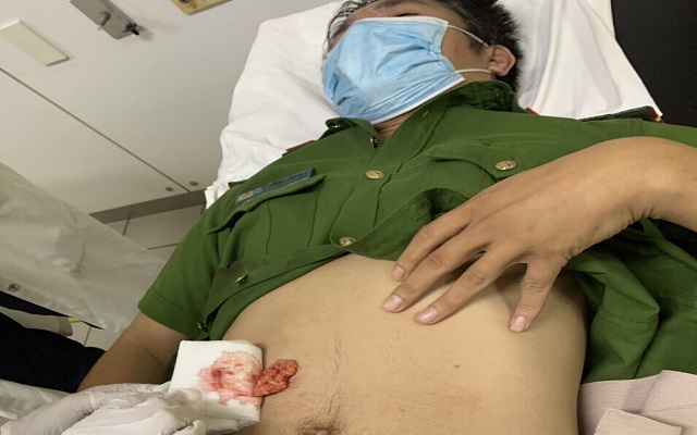 Thừa Thiên Huế: Một chiến sĩ công an bị đâm trọng thương khi đang làm nhiệm vụ - Ảnh 1.