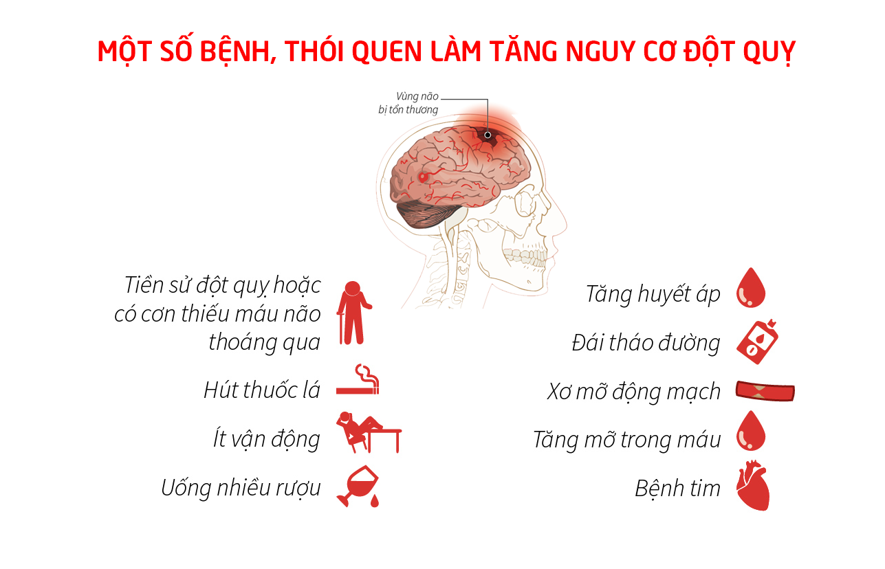 Hiểu Các Yếu Tố Nguy Cơ đột Quỵ để Phòng Ngừa Sớm