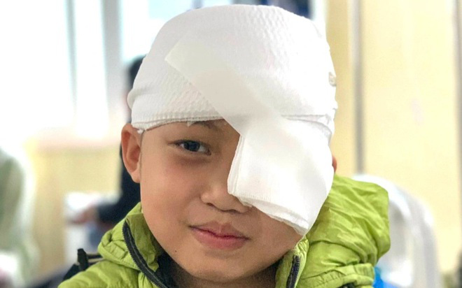  Cậu bé có khối u 'khủng' ở mắt trái đã khóc khi nhìn thấy mẹ sau ca phẫu thuật thành công