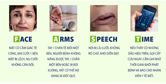 3 dấu hiệu sớm cảnh báo đột quỵ trước cả FAST - Ảnh 1. 3 dấu hiệu sớm cảnh báo đột quỵ trước cả FAST - Ảnh 1.