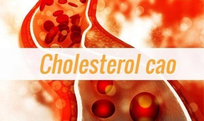 Cholesterol cao: Thủ phạm nguy hiểm gây ra những bệnh lý về tim mạch 