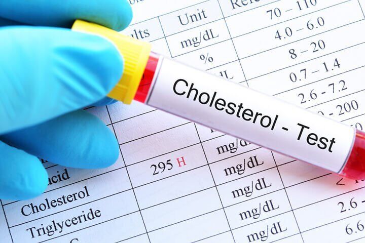 Cholesterol: Thủ phạm gây ra những bệnh lý về tim mạch cần lưu ý - Ảnh 2.