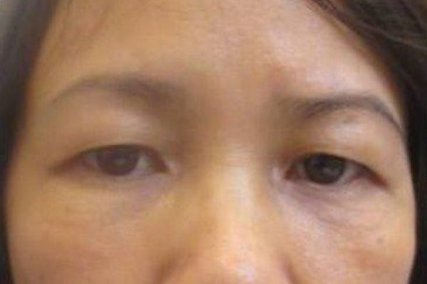 Foxy Eyes – phương pháp giải cứu đôi mắt cụp rũ buồn - Ảnh 2.