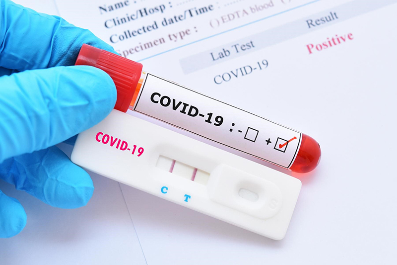 (Test) Chuyên gia khuyến cáo- Bệnh nhân ung thư tiết niệu cần làm gì trong dịch COVID-19? - Ảnh 3.