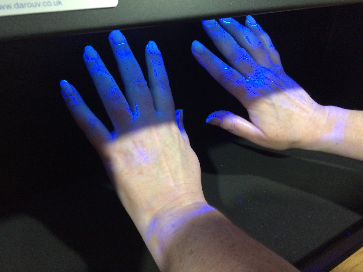 Không nên sử dụng đèn diệt khuẩn cực tím (UV) để khử trùng tay hoặc các vùng da khác - Ảnh 3.
